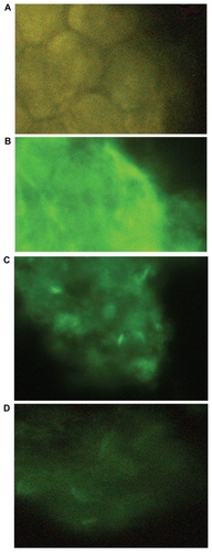 Figure 3 Immunocytochemistry on HT29. Protein level of CXCR4 in HT29 was characterized by immunocytochemistry using rabbit polyclonal CXCR4 antibody and FITC-conjugated goat-antirabbit IgG. A) Negative control with deletion of the primary antibody. B) HT29 transfected with nontarget siRNA control. C) HT29 transfected with CXCR4 siRNA I and II. D) HT29 transfected with CXCR4 siRNA/ dextran-spermine.