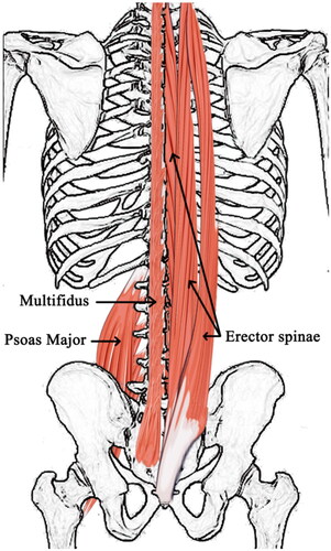 Figure 1. The anatomy of multifidus, psoas major and erector spinae.