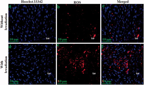 Figure 11. ROS level evaluation under irradiation in 6 h incubation with DOX/5-ALA-CQD-Glu-β-CD nanocarrier in breast cancer (MCF-7) cell line without (a–c) and with radiation (d–f) scale bar: ∼10 μm.