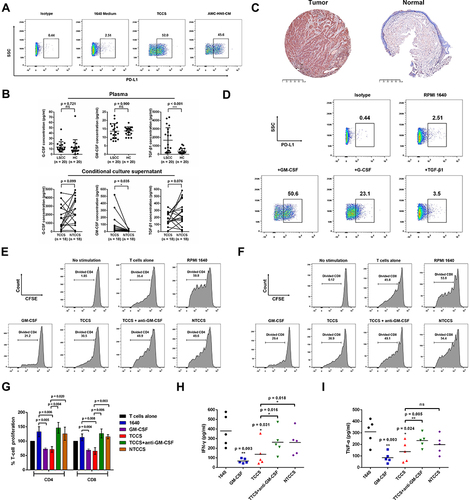 Figure 5 LSCC tumor microenvironment remodels and regulates the phenotype and function of neutrophils. (A) TCCS or cultural medium from AMC-HN-8 cells upregulated the level of immunosuppressive molecule PD-L1 on neutrophils. (B) ELISA detected the concentration of GM-CSF, G-CSF and TGF-β1 in the plasma, TCCS and NTCCS of LSCC patients. (C) Representative images were shown for GM-CSF IHC staining (magnification, X 50) of tumor tissues and normal tissues from LSCC patients. Bars = 500μm. (D) Cytokine GM-CSF most significantly upregulated the level of immunosuppressive molecule PD-L1 on neutrophils. (E-G) Representative histograms and statistics analysis of the proliferative capacity of CD4+T cells and CD8+ T cells following the coculture of PANs from LSCC patients with PBMCs at different stimuli. (H and I) IFN-γ and TNF-α production of T cells following the coculture of PANs from LSCC patients with PBMCs at different stimuli. ns = p > 0.05, *p < 0.05, **p < 0.01, ***p < 0.001.