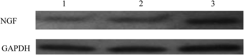 Figure 3. NGF protein expressions in spinal cord tissues 28 d after SCI (1: sham surgery group; 2: model group; 3: WJC transplantation group).