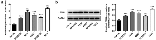 Figure 1. The expression of LETM1 in ESCC cells. (a) The mRNA expression of LETM1 in ESCC cells; (b) The protein expression of LETM1 in ESCC cells. ***P < 0.001 vs. Het-1A