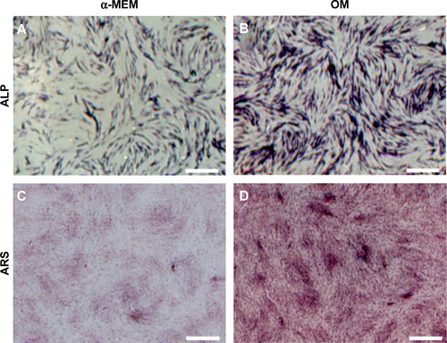 Figure S6 ALP and ARS staining of hMSCs on TCP.Notes: Representative staining of ALP on TCP surface under non-osteoinductive condition (A) and osteoinductive condition (B) at day 14. ARS staining on TCP surface under non-osteoinductive condition (C) and osteoinductive condition (D) at day 21.Abbreviations: ALP, alkaline phosphatase; TCP, tissue culture plate; ARS, Alizarin Red S; OM, osteoinductive media; α-MEM, α-Minimum Essential Medium; hMSC, human mesenchymal stem cell.