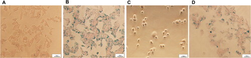 Figure 5. Cellular uptake of CSO-SPION and GE11-CSO-SPION micelles. Prussian blue staining images of micelles in HepG2 cells after incubation with CSO-SPION (A) and GE11-CSO-SPION (B) (50 μg mL−1) for 1 h. Prussian blue staining images of micelles in L-O2 (C) and HepG2 cells (D) after incubation with GE11-CSO-SPION (50 μg mL−1) for 1 h. 200X magnification; 50 μm scale.