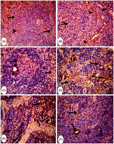 Figure 4. Representative photomicrographs of immunohistochemical staining for CD4+ cells in mouse spleens. (A) Group C: slight presence of CD4+ cells in the white pulp (arrowhead) and increased presence in red pulp/subcapsular areas (arrows) (Score 1). Magnification 400×. (B) and (C) Group MA: strong presence of CD4+ cells around splenic sinusoids (arrowheads) and lymphoid cells in red pulp (arrow). Magnification 200×. CD4+ cells in white and red pulp germinal centers (arrows) (Score 3). Magnification 400×. (D) and (E) Group FA: strong presence of CD4+ cells in both white and red pulp (arrows) (Score 3). Magnification 400×. (F) Group (MA + FA): moderate increases in the presence of CD4+ cells in white pulp (arrows) (Score 2). Magnification 400×.