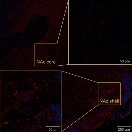 Figure S2 Images showing MOR immunofluorescence in various ROIs of the brain slices.