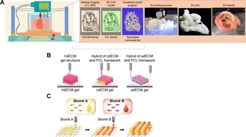 Figure 4 Process of 3D bioprinting, (A) steps of 3D bioprinting, (B) pre-scaffold fabrication bioprinting, (C) simultaneous hybrid 3D bioprinting.Abbreviations: 3D, three-dimensional; CAD, computer-aided design; PCL, polycaprolactone; hdECM, heart decellularized-extracellular matrix; cdECM, cartilage decellularized-extracellular matrix; adECM, adipose decellularized-extracellular matrix.