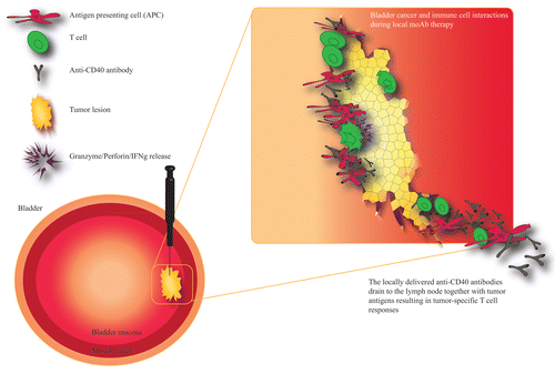 Figure 1. Localized or disseminated bladder cancer can be treated with peritumoral or intratumoral injections of CD40 agonistic antibodies. Various immunotherapeutics, including CD40 agonistic antibodies, can be easily administered into neoplastic lesions growing in the bladder urothelium by ultrasound-guided or transurethral injections. CD40 agonistic antibodies can then activate tumor-infiltrating immune cells as well as immune cells in the tumor-draining lymph node. The drainage of these antibodies is paralleled by that of tumor debris, resulting in the efficient priming and/or activation of tumor-specific T cells. These T lymphocyte can home to the tumor and exert antineoplastic effects by multiple mechanisms, including perforin/granzyme-induced apoptosis. Tumor-specific T cells can also control metastatic lesions and prevent disease recurrence.