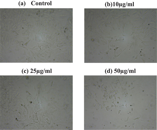 Figure 8. Pedalium murex L. copper nanoparticles treated against A549 lung cancer cell line in (a) control, (b) 10 µg/ml, (c) 25 µg/ml and (d) 50 µg/ml.