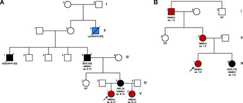 Figure 2. Pedigrees. (A) Pedigree A. (B) Pedigree B. White symbols represent unaffected individuals; red filled symbols represent individuals with thrombocytopenia and no myeloid malignancy; black filled symbols represent individuals with myeloid neoplasm; blue filled symbols represent individuals with other malignancies; WT (wild type) represents individuals that do not carry the pathogenic exonic RUNX1 deletion detected in the family. AML: acute myeloid leukemia; MDS: myelodysplastic syndrome; MDS/MPN: myelodysplastic/myeloproliferative neoplasm. Age at diagnosis is provided in parenthesis for affected individuals.Blue, red and black represent different symptoms/diseases of the patients.