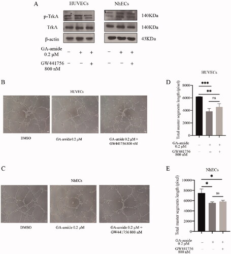 Figure 5. The inhibition of TrkA could not reverse the antiangiogenic effects of GA-amide on HUVECs and NhECs. (A) The inhibitory effects of GW441756 (TrkA inhibitor) on TrkA in HUVECs and NhECs were evaluated by Western blot. (B,C) Representative images showing the antiangiogenic effects of GA-amide with or without GW441756 on HUVECs (B) and NhECs (C). (D,E) Quantitative analysis of (B) and (C). Images were analyzed by ImageJ software, and the numbers of capillary-like structures in five separated fields of one well was calculated. Scale bar, 200 μm. Data are presented as the means ± S.D. of three independent determinations. *p < 0.05, **p < 0.01 and ***p < 0.001 compared with DMSO by two-tailed Student’s t-test.