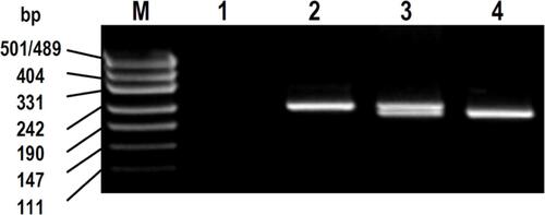 Figure SA1 BanI restriction fragment patterns for 2677G > T genotyping.Notes: bp: size of marker bands in base pairs; M: pUC19/HpaII DNA molecular weight marker; 1, negative control; 2, homozygous variant genotype (T/T) with 224 bp undigested polymerase chain reaction product; 3, heterozygous genotype (G/T) with 224 bp undigested + 198 bp digested fragment; and 4, homozygous wild-type genotype (G/G) with 198 bp digested fragment. 26 bp digested fragments not visible on gel.