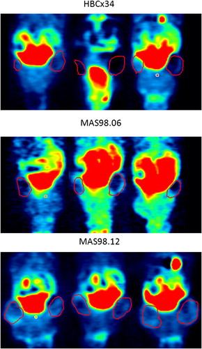 Figure 1. Coronal [18F]FECh PET images for the HBCx34, MAS98.06 and MAS98.12 xenografts 90 minutes after [18F]FECh injection. Red line indicates location of bilaterally implanted xenografts. Volumes of interest were delineated in the corresponding computer tomography image.