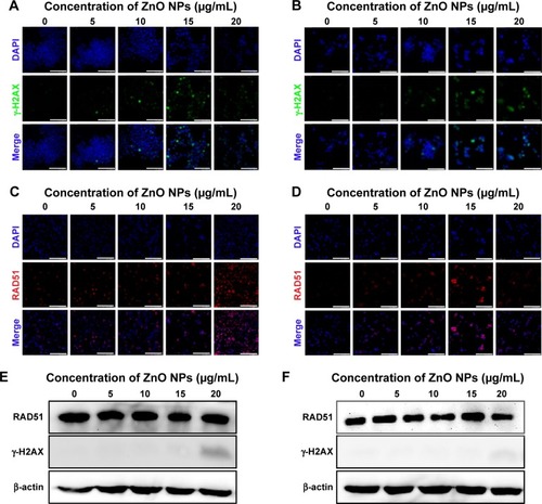 Figure 8 Nuclear DNA damage in LCs and SCs after ZnO NP treatment.Notes: (A and B) Nuclear γ-H2AX foci in cells exposed in vitro to ZnO NPs for 12 hours. (C and D) Nuclear RAD51 foci in cells exposed in vitro to ZnO NPs for 12 hours. (E and F) Western blots for γ-H2AX and RAD51 in LCs and SCs. The results are expressed as the mean ± standard deviation of three separate experiments, in triplicate. (A, C, and E) are the data of LCs; (B, D, and F) are the data of SCs. Scale bars =150 μm.Abbreviations: DAPI, 4′,6-diamidino-2-phenylindole; LCs, Leydig cells; NPs, nanoparticles; SCs, Sertoli cells.