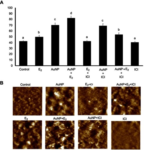 Figure 3 Effects of the ER-antagonist (ICI) on the E2-induced increase of the MCF-7 cell membrane roughness, in the absence and presence of AuNP. (A) Graphic shows significant differences in the roughness values at 12 hrs of incubation with different treatments compared with the control group (ethanol-treated cells). Results were obtained sequentially in three different areas of the cell and on three different cells, in triplicate. Different letters (a-d) show statistical differences between groups in the RMS[Rq] value; *P≤0.05 vs control. (B) Representative high-resolution AFM images show changes in the surface roughness of the MCF-7 cell membrane under different treatments. The image size: 5×5 µm, with Z=0 a 250 nm. (0.25 µm).Abbreviations: AFM, atomic force microscopy; AuNP, gold nanoparticle; E2, 17β-estradiol; ICI, 7α,17β-[9-[(4,4,5,5,5-Pentafluoropentyl)sulfinyl]nonyl]estra-1,3,5(10)-triene-3,17-diol; RMS[Rq], roughness values; Vh, vehicle.