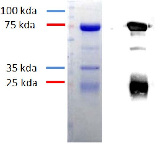 Figure 3. Detection of egg yolk antibody. Notes: Results of egg yolk antibody detection test by 12% SDS-PAGE.