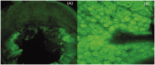 Figure 4. Confocal microscopic image showing Peyer’s patch region of the animal (A) plain antigen (B) Guar gum nanoparticles.