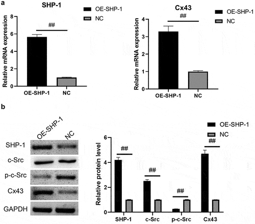 Figure 1. SHP-1, c-Src, p-c-Src, and Cx43 expression after overexpression of SHP-1 was detected by qPCR and western blot. (a) qPCR was used to detect the gene expression of SHP-1 and Cx43 in HL-1 cells. (b) The expression of SHP-1, c-Src, p-c-Src, and Cx43 in HL-1 cells was detected by WB, and semi-quantitative analysis based on gray value was performed. OE-SHP-1, HL-1 cells transfected with SHP-1 overexpression lentivirus. NC, HL-1 cells transfected with lentivirus vector. ##, p < 0.01.