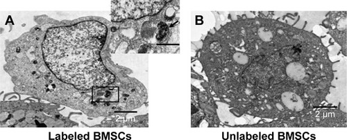 Figure 3 TEM images of MNP-Mn(II)-labeled BMSCs and unlabeled BMSCs; scale bars =2 µm. (A) Black particles representing the internalized MNP-Mn(II) were observed in the cytoplasm and endosomes of labeled BMSCs (enlarged in the upper right corner). (B) No black particles were observed in endosomes of unlabeled BMSCs.Abbreviations: BMSCs, bone marrow-derived stem cells; MNP-Mn(II), manganese (II) ions chelated to melanin nanoparticles; TEM, transmission electron microscopy.