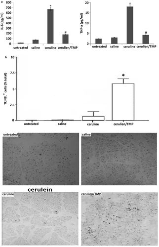 Figure 2. TMP inhibits serum TNF-α and IL-6 levels and promotes apoptosis in cerulein-induced pancreatitis. (a), Serum levels of interleukin (IL)-6 and tumor necrosis factor (TNF)-αwere detected 12 h after induction of acute pancreatitis or treated with TMP before the induction of acute pancreatitis. (b), Cell apoptosis was detected by TUNEL assay. Data are presented as mean ± SEM.*P< 0.05; #P< 0.05.