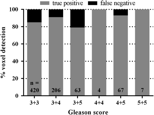 Figure 4. Percentage of true-positive and false-negative tumour voxels for the different Gleason scores. We found a trend that the tumour voxels with higher Gleason score (GS ≥ 3 + 4) score were easier to detect (p = 0.06). N, total amount of voxels per Gleason score.