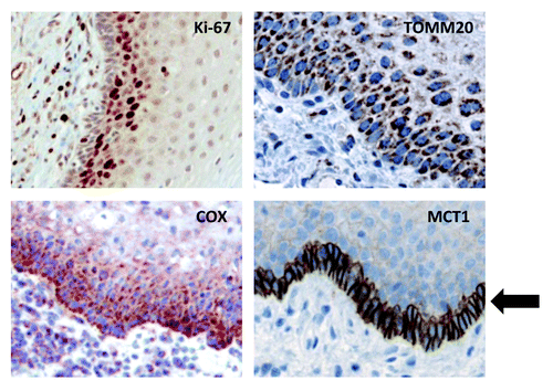 Figure 2. MCT1 is a specific marker for basal stem cells, and co-distributes with markers of proliferation (Ki-67) and mitochondrial metabolism (TOMM20 and COX). As in Figure 1, except that selected areas are shown at a higher magnification to better appreciate the staining of the basal stem cell layer. An arrow points at MCT1 staining, which is a specific marker for basal stem cells.