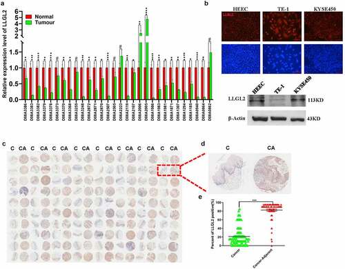 Figure 2. LLGL2 expression is inversely correlated with SOX2 in clinical biopsies. A. mRNA level of LLGL2 in ESCC tissues was significantly lower than that in cancer-adjacent tissues (n = 30). *p < .05, **p < .01, ***p < .001, ****p < .0001 vs. control. Data are the means ± SDs. B. LLGL2 is expressed in HEEC, TE-1 and KYSE450 cells. The upper panel presents the immunofluorescence results, and the lower panel presents the western blot results. Scale bar: 100 μm. C. Downregulated expression of LLGL2 protein in ESCC clinical samples (C) versus cancer adjacent samples (CA) according to the tissue microarray (n = 80). D. Representative images of LLGL2 immunochemistry in ESCC clinical samples (C) versus cancer adjacent samples (CA). E. LLGL2 protein levels in ESCC tissues were significantly lower than those in cancer-adjacent tissues (n = 80, p < .001).