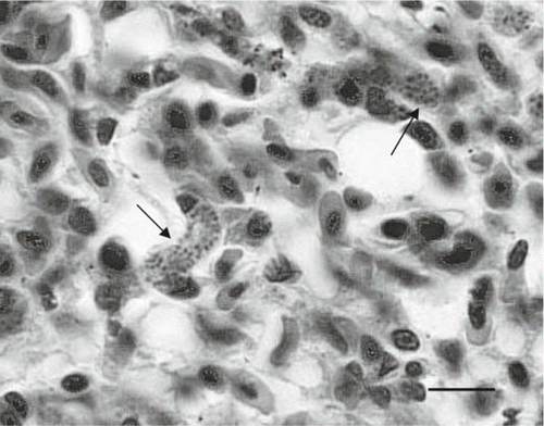 Figure 2. High-power light photomicrograph of a section of lung from a mohua (Bird 4) which died due to infection with Plasmodium spp., showing swollen endothelial cells containing numerous intracytoplasmic protozoal organisms (arrows) (H&E, bar=10 µm).