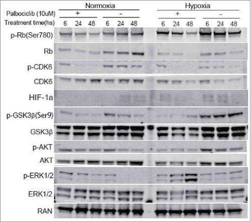 Figure 3. Palbociclib therapeutic effects against CRC cells via regulation of various cellular signaling pathways under normoxia and hypoxia. RKO colon cancer cells were treated at the indicated time points with palbociclib (10 μM) under normoxia (Left panels) and hypoxia (Right panels). Whole cell lysates were separated in 4–12% SDS-PAGE gels.