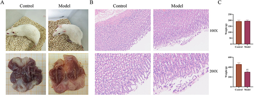 Figure 3 Evaluation of CAG model establishment. (A) General state of rats and macroscopic manifestation of gastric tissue in the control and model group. (B) HE staining of gastric tissue in control group and model group. (C) Changes of body weight of rats in control group and model group. All data were expressed as means ± standard deviation (SD). Two group comparisons were analyzed by unpaired two tailed Student’s t-test. ##P < 0.01 vs control group.