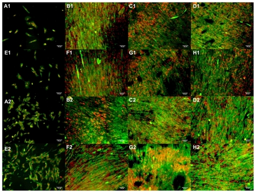 Figure 9 Immunofluorescence images of C2C12 cultured for four days on (A) glass, (B) 5PU, (C) SWNT-5PU, (D) MWNT-5PU, (E) gold sputter-coated glass, thickness about 8 nm, (F) 10PU, (G) SWNT-10PU, and (H) MWNT-10PU. (−1) indicates without electrical stimulation and (−2) indicates with electrical stimulation.Note: Scale bars are 50 μm. Myosin heavy chains were stained with fluorescein (green) and nuclei were marked with propidium iodide (red).Abbreviations: MWNT, multiwalled nanotubes; SWNT, single-walled nanotubes; 5PU, 5% w/v polyurethane; 10PU, 10% w/v polyurethane.