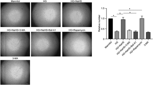 Figure 3. Exogenous H2S promoted EPCs tube formation in vitro under the HG condition. Tube formation of EPCs among the 7 groups was evaluated by tube formation assay. Left panel: representative micrographs of the invasiveness of EPCs (scale bar = 500 µm). Right panel: quantification analysis of tube formation in EPCs. All experiments were repeated 3 times, and the numerical results were expressed as mean ± SD. One-way ANOVA was used to compare the differences among the 7 groups, and significant differences between treatment groups were indicated as *P < 0.05.