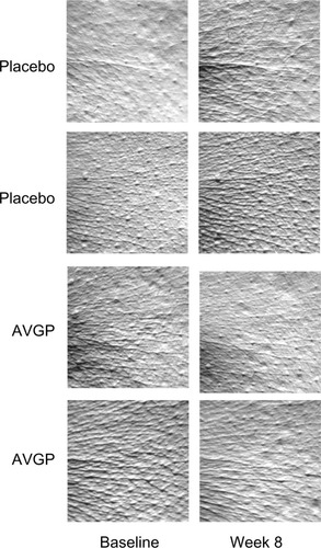 Figure 4 Effects of oral AVGP therapy facial skin hydration.
