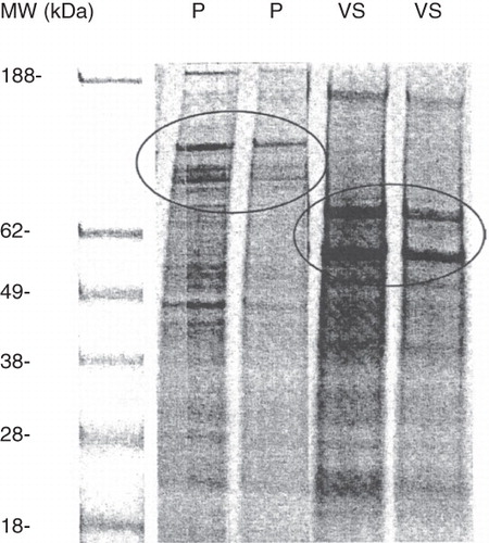 Figure 1.  SDS-polyacrylamide electrophoresis (SDS-PAGE) of seminal prostasomes (P) and vesicular seminalis secretion (VS) at two different concentrations. Molecular markers in lane 1 (MW). Prostasome marking CD proteins (at 150, 120 and 90 kDa) encircled in the SDS-PAGE pattern lanes marked P. HSP70 and clusterin (at 70 and 55 kDa) encircled in SDS-PAGE pattern lanes marked VS.