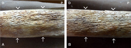 Figure 1. Medial surface of left tibia, middle third (panel A) and distal third (panel B). Linear arrows show anterior borders and arrowheads show posterior borders. P: proximal end; D: distal end.