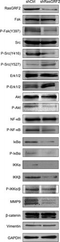 Figure 5. RasGRF2-regulated expression of MMP9 is dependent on Src/PI3K/Akt/NF-κB signaling pathway. Western blot analysis of phosphorylation status of various signaling proteins in RasGRF2-downexpressing CRC cell. GAPDH was used as the internal control for total proteins.