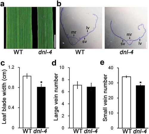 Figure 4. The dnl-4 mutant has defects in the vascular system of the leaf blade