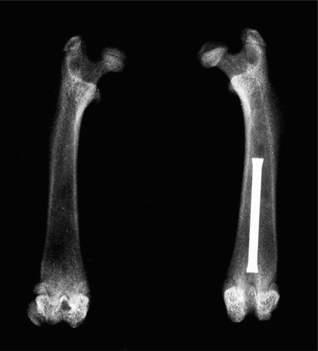 Figure 1. Retrogradely inserted hollow needle (16 G, 1.5 mm).