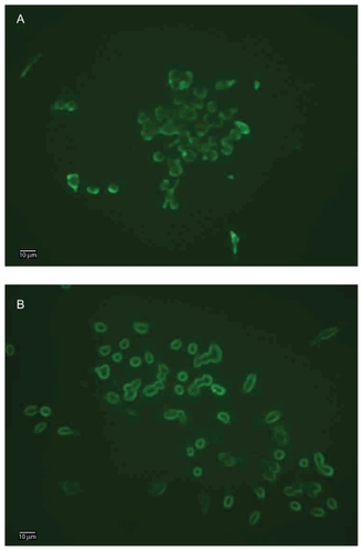 Figure 3 Fluorescence microscopy images of macrophage–Qdot hybrids. A) Macrophage–T-Qdot: macrophages treated with sodium periodate, incubated with QD525 for four hours, and fixed; B) Macrophage–S-Qdot: macrophages treated with sodium periodate, incubated with QD525 for four hours, treated with sodium cyanoborohydride, and fixed.Notes: Original magnification, ×400; scale bar, 10 μm.Abbreviation: Qdot, quantum dot.