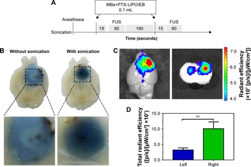 Figure 6 Comparisons of the EB dye or liposomes that penetrate through BTB-compromised glioma to those that penetrate through the BTB disrupted by FUS.Notes: (A) Experimental timeline of the treatment procedure of the BTB opening in vivo induced by FUS with MBs. (B) EB extravasation in glioblastoma. Left: without FUS sonication with MBs. Right: with FUS sonication with MBs. Note that without treatment with FUS or MBs, EB was distributed heterogeneously within the tumor region. However, after insonification in the presence of MBs, EB spread throughout most of the tumor region. (C) Liposome accumulation in tumor regions through the glioma-compromised BTB (left) and FUS-disrupted BTB (right). The same amount of U87 MG cells was implanted in the bilateral striatum in the nude mouse brains. FUS was only introduced to the right intracranial glioblastoma. (D) Fluorescence intensity of the extravasated liposomes in the left and right tumor regions (n=6, mean ± SD). **P<0.01.Abbreviations: BTB, blood–tumor barrier; EB, Evans blue; FUS, focused ultrasound; MBs, microbubbles; PTX-LIPO, paclitaxel liposomes.