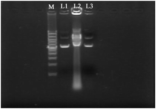 Figure 9. Agarose gel electrophoresis image of c-Myc-siRNA3-pDNAs on exposure to DNase I: L1, original c-Myc-siRNA3-pDNAs; L2, original c-Myc-siRNA3-pDNAs incubated with DNase I for 2 h; L3, NPs-c-Myc-siRNA3-pDNAs incubated with DNase I for 2 h; M, marker.