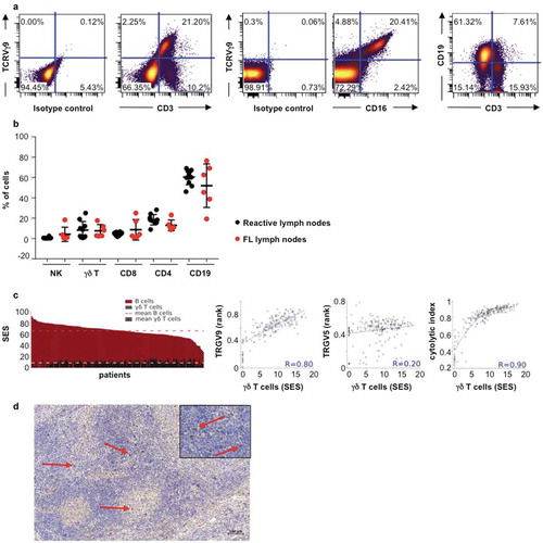 Figure 1. TCRVγ9Vδ2 T cells in FL lymph node biopsies. (a) Representative dot plots of γδ T cells (TCRVγ9+/CD3+), B cells (CD19+/CD3−), and TCRVγ9+/CD16+ cells. (b) Quantification of total B, γδ T, NK (CD3−CD56+) cells, CD4+ and CD8+ lymphocytes from healthy tonsils (black circle, n = 10) and FL lymph nodes (red circle, n = 10). (c) Sample enrichment scores (SES) of different cells subtypes in 198 FL patients and correlation of “γδ T-cell” SES with expression levels of the TRGV9 and TRGV5 genes, and the cytolytic index. (d) Representative section from FL lymph node showing TCR gamma chain staining (red arrow) (bar = 100µm); original magnification x100; zoom insert: original magnification x400).