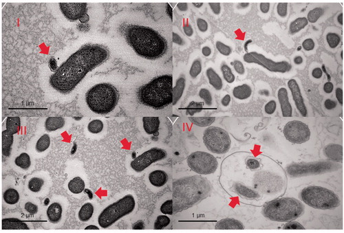 Figure 2. TEM images of various stages of predation. The prey in the images is an Enterobacter roggenkampii isolate. Images I, II and III show B. bacteriovorus HD100 (indicated with arrows) attached to the outer surface of a prey cell or in its immediate surroundings. Image IV shows a late stage of predation where the new-born predators are in the bdelloplast, prior to its disruption (our unpublished data).