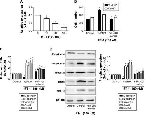 Figure 5 ET-1 promotes cell migration and EMT expression by downregulating miR-300 expression in OSCC cells.