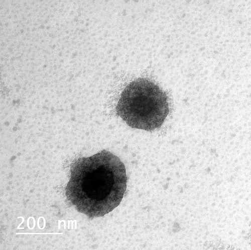 Figure 2 Transmission electron microscope photo micrographs of SIM-CB.