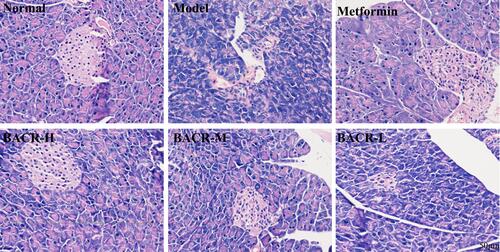 Figure 6 Pancreatic histological changes by HE staining (400×) (n=10). Metformin group: 320mg/kg; BACR-H group: 120mg/kg; BACR-M group: 60mg/kg; BACR-L group: 30mg/kg.
