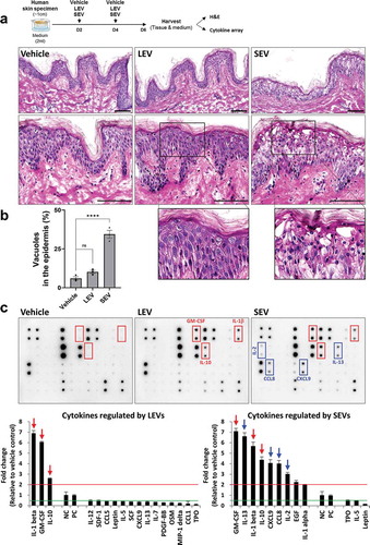 Figure 2. LEV treatment enhances the secretion of anti-inflammatory cytokine IL-10 in human skin organ cultures. Human cultured skin tissues were treated twice with vehicle (HBS), LEVs (50 μg/mL), or SEV (50 μg/mL) during a 6-day culture period. Tissues and supernatants were harvested on day six for H&E staining and cytokine array analysis (n = 2; two independent tissue samples). (a) Scheme of bacterial EV treatment of human skin cultures and H&E staining. The outlined area is enlarged. Scale bars, 100 μm. (b) Abnormality of the epidermis was quantified by measuring the ratio of the number of vacuoles (empty space due to cytoplasmic loss) to the total number of cells in the epidermis. Data are expressed as the mean ratio ± SEM of three different images and statistical significance was analysed by one-way ANOVA. ****p < 0.0001; ns, non-significant. (c) Representative immunoblot images of cytokine array analysis. Markedly increased cytokines by LEV and SEV treatments are indicated by red-coloured boxes and arrows. Inflammatory cytokines that are preferentially, and significantly, increased by SEV treatment are indicated by blue-coloured boxes and arrows. Cytokines that are more than 2-fold increased or decreased in LEV- or SEV-treated compared to vehicle-treated groups are shown left or right, respectively, on the basis of NC/PC in the graph (red line for 2-fold increase; green line for 2-fold decrease). The average fold change in LEV- or SEV- treated groups relative to vehicle control was determined by densitometry using ImageJ (https://imagej.nih.gov/ij/). NC/PC, negative control/positive control of the spots in cytokine array.