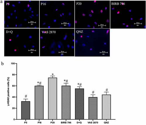 Figure 3. Treatments with senotherapeutics diminish senescence-induced DNA damage. Replicative senescence, realized by repetitive cell culture, markedly increased the percentage of γ-H2AX-positive cells in late passage (p20) human BMECs compared to young (p5) and mid-passage (p16) cells. Treatments of p16 cells with senomorphics targeting p38MAPK (BIRB 796), NF-κB (QNZ) or NADPH oxidase (VAS2870) or senolytics (dasatinib and quercetin; D + Q) until p20 diminished the percentage of γ-H2AX-positive cells (a, b). Scale bars: 50 μm. The γ-H2AX stainings were visualized using 40x magnification. Data are expressed as mean ± SEM from three independent experiments. *P < .05 compared to p5 BMECs. # P < .05 compared to p20 BMECs.