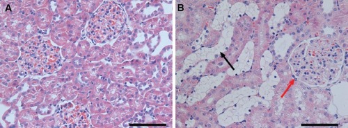 Figure 4 Hematoxylin and eosin staining of the renal cortex of (A) normal rats and (B) diabetic rats. The red arrow indicates the glomerulus and the black arrow indicates the tubule.Note: Scale bars: 100 μm.
