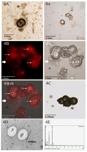 Figure 4 Identification of CNPs in cultures. A) IHS positive result using anti-CNPs monoclonal antibody. a) Negative control by IHS. B) IIFS positive results of cultured CNPs using anti-CNPs monoclonal antibody. b) The same view under the light microscope by IIFS. B + b) Merged picture of image under fluorescence and light microscope. Thin arrow represents positive signals, and those represented by thick arrows show the negative control by IIFS. C) von Kossa staining of the CNPs. D) TEM image of the CNPs at 20,000× magnification, showing 200–400 nm spherical particles. E) Chemical analysis of CNPs by EDX showed calcium and phosphate peaks.